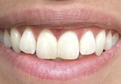Springhill Dental